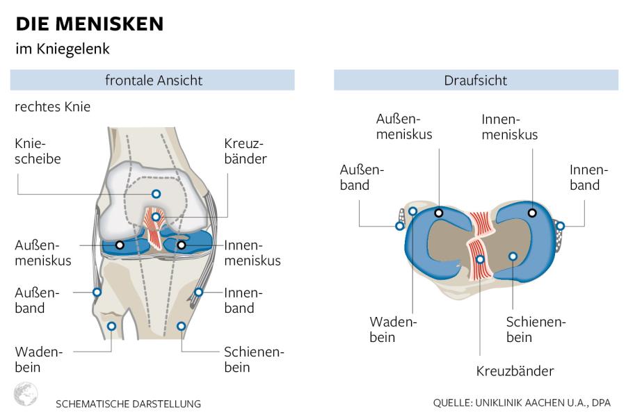 Meniskus-Kniegelenk.jpg